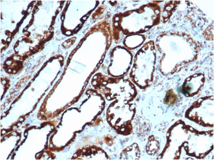 Formalin-fixed, paraffin-embedded human thyroid stained with HSP60 Antibody (rHSPD1/6495).