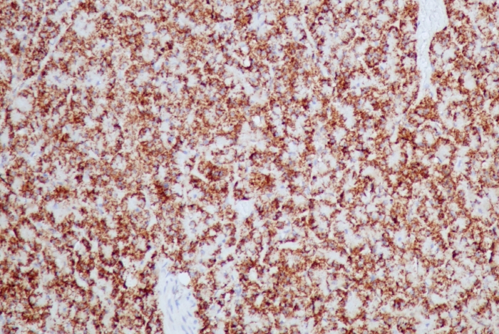 Formalin-fixed, paraffin-embedded dog pancreas stained with HSP60 Antibody (HSPD1/2206R).