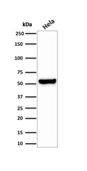 Western blot analysis of HeLa cell lysate using HSP60 Antibody (HSPD1/2206R).