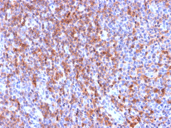 Formalin-fixed, paraffin-embedded human Tonsil stained with ICAM-3/CD50 Antibody (ICAM3/2873R).