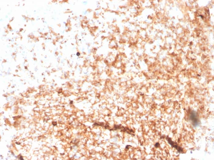 Formalin-fixed, paraffin-embedded human Tonsil stained with IgM Antibody (rIGHM/3802).