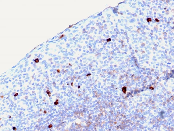 Formalin-fixed, paraffin-embedded human Tonsil stained with IgM Antibody (rIGHM/2558).