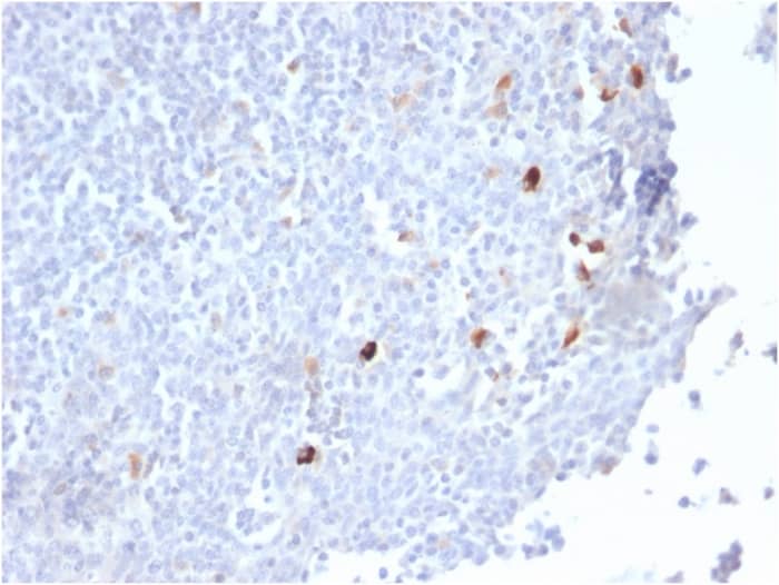 Formalin-fixed, paraffin-embedded human Tonsil stained with IgM Antibody (IGHM/2559R).