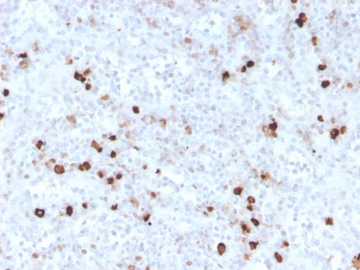 Formalin-fixed, paraffin-embedded human spleen stained with IgM Antibody (IGHM/3776R).