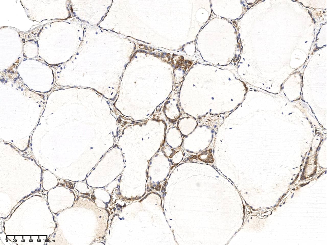 Immunohistochemistry-Paraffin: ODR4/TTG1 Antibody - Azide and BSA Free [NBP3-49165] - Immunochemical staining of human ODR4/TTG1 in human thyroid gland with NBP3-49165 at 1:100 dilution, formalin-fixed paraffin embedded sections.