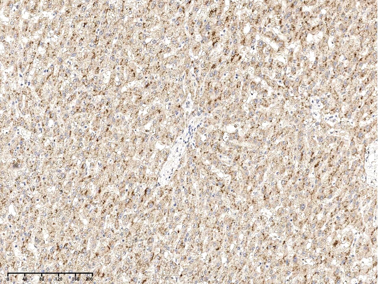 Immunohistochemistry-Paraffin PXMP4 Antibody - Azide and BSA Free