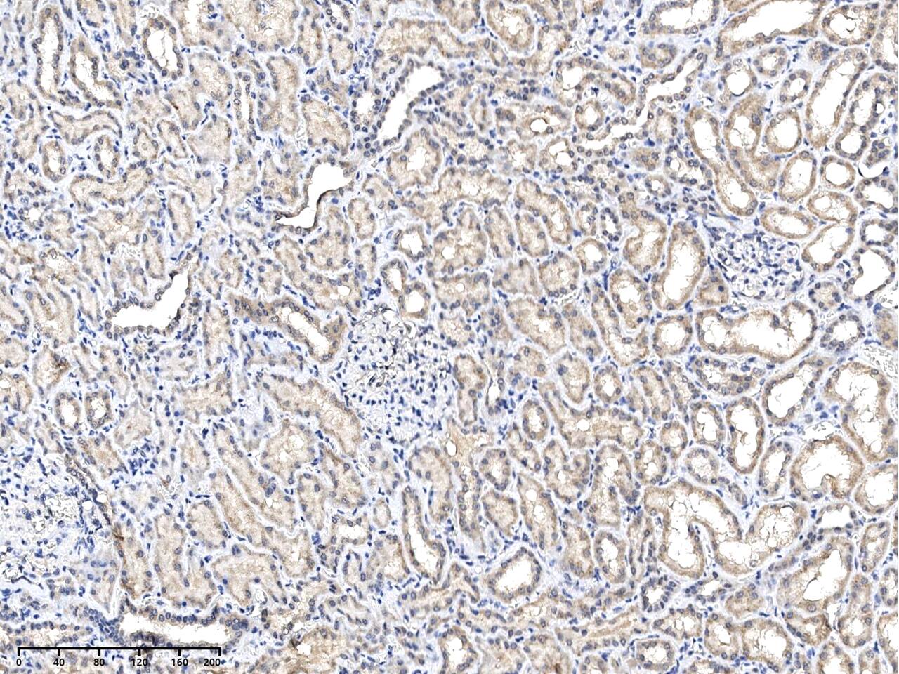 Immunohistochemistry-Paraffin PXMP4 Antibody - Azide and BSA Free