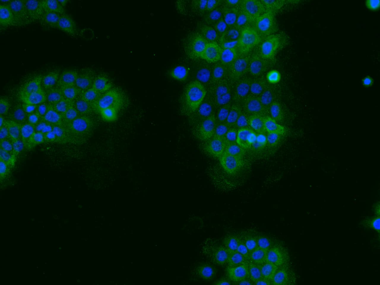 Immunocytochemistry/ Immunofluorescence: XK X-linked Kx blood group Antibody - Azide and BSA Free [NBP3-49155] - Immunofluorescence staining of XK in A431 cells. Cells were fixed with 4% PFA, permeabilzed with 0.3% Triton X-100 in PBS, blocked with 10% serum, and incubated with NBP3-49155 (dilution ratio 1:100) at 4C overnight. Then cells were stained with Alexa Fluor®488-conjugated Goat Anti-rabbit IgG secondary antibody (green) and counterstained with DAPI (blue). Positive staining was localized to Cytoplasm.