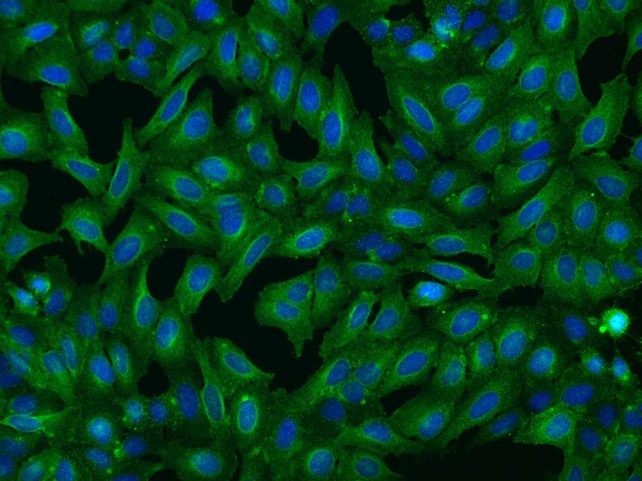 Immunocytochemistry/ Immunofluorescence: CCDC5 Antibody - Azide and BSA Free [NBP3-49164] - Immunofluorescence staining of CCDC5 in U2OS cells. Cells were fixed with 4% PFA, permeabilzed with 0.1% Triton X-100 in PBS, blocked with 10% serum, and incubated with NBP3-49164 (dilution ratio 1:200) at 4C overnight. Then cells were stained with Alexa Fluor®488-conjugated Goat Anti-rabbit IgG secondary antibody (green) and counterstained with DAPI (blue). Positive staining was localized to Cytoplasm.