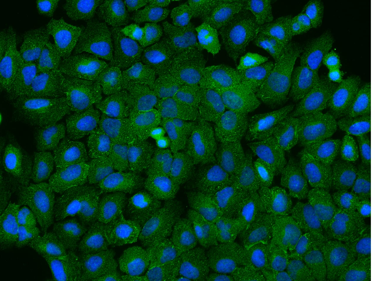 Immunocytochemistry/ Immunofluorescence: ODR4/TTG1 Antibody - Azide and BSA Free [NBP3-49165] - Immunofluorescence staining of ODR4/TTG1 in U2OS cells. Cells were fixed with 4% PFA, permeabilzed with 0.3% Triton X-100 in PBS, blocked with 10% serum, and incubated with NBP3-49165 (dilution ratio 1:100) at 4℃ overnight. Then cells were stained with Alexa Fluor®488-conjugated Goat Anti-rabbit IgG secondary antibody (green) and counterstained with DAPI (blue).Positive staining was localized to Cytoplasm.