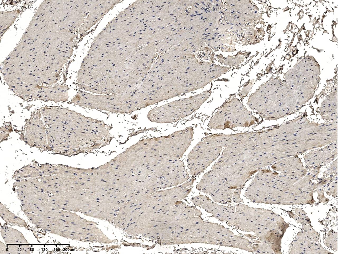 Immunohistochemistry-Paraffin: ODR4/TTG1 Antibody - Azide and BSA Free [NBP3-49165] - Immunochemical staining of human ODR4/TTG1 in human urinary bladder with NBP3-49165 at 1:100 dilution, formalin-fixed paraffin embedded sections.