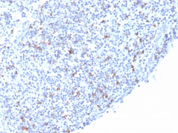 Formalin-fixed, paraffin-embedded human Tonsil stained with Integrin alpha E/CD103 Antibody (rITGAE/2063) - Azide and BSA Free.