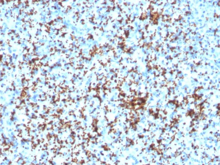 Formalin-fixed, paraffin-embedded human Spleen stained with Integrin beta 3/CD61 Antibody (ITGB3/3126R) - Azide and BSA Free.