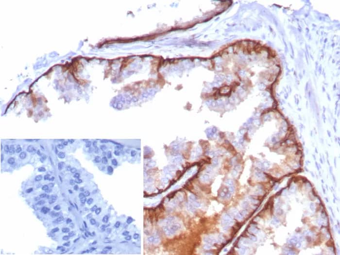 Formalin-fixed, paraffin-embedded human tonsil stained with Cytokeratin 5 Antibody (KRT5/8814R) - Azide and BSA Free. Inset: PBS instead of primary antibody; secondary only negative control.