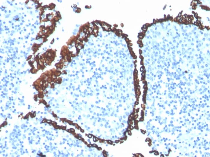 Formalin-fixed, paraffin-embedded human tonsil stained with Cytokeratin 5 Antibody (KRT5/4245R) - Azide and BSA Free.