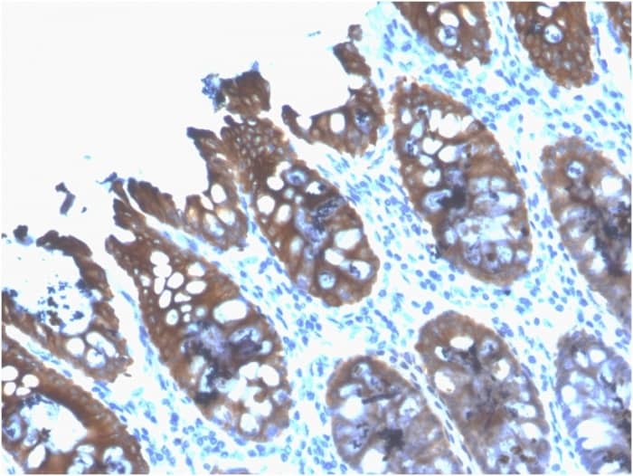 Formalin-fixed, paraffin-embedded human Colon stained with Cytokeratin 8 Antibody (rB22.1) - Azide and BSA Free.