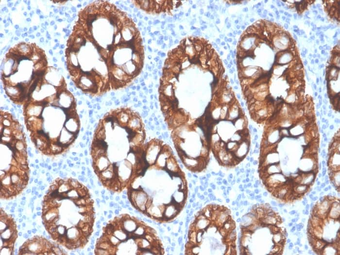 Formalin-fixed, paraffin-embedded human colon stained with Cytokeratin 8 Antibody (rKRT8/4209) - Azide and BSA Free.