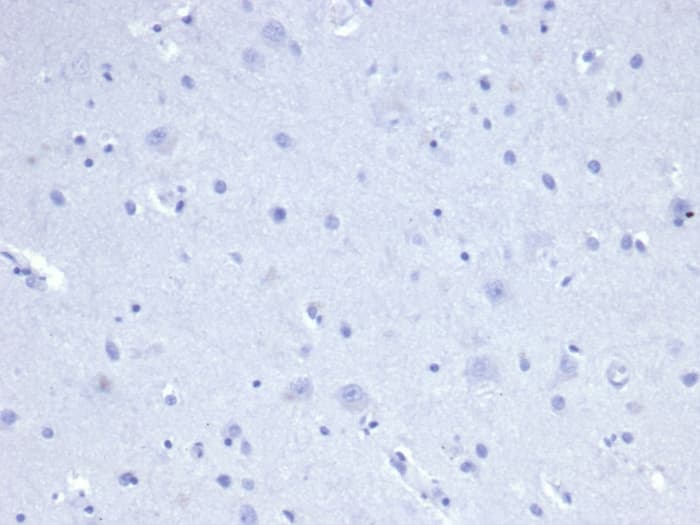 IHC analysis of formalin-fixed, paraffin-embedded human brain. Negative tissue control using Cytokeratin 8 Antibody (rKRT8/4209) - Azide and BSA Free at 2ug/ml in PBS for 30min RT. HIER: Tris/EDTA, pH9.0, 45min. 2�C: HRP-polymer, 30min. DAB, 5min.