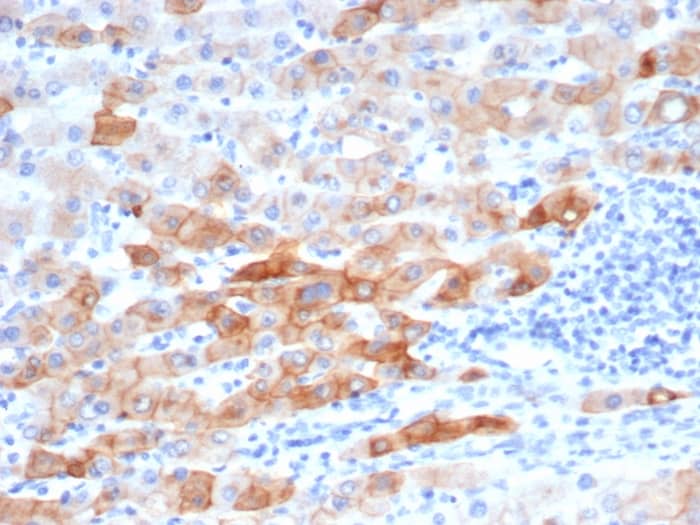 Formalin-fixed, paraffin-embedded human colon stained with Cytokeratin 8 Antibody (rKRT8/6471) - Azide and BSA Free.