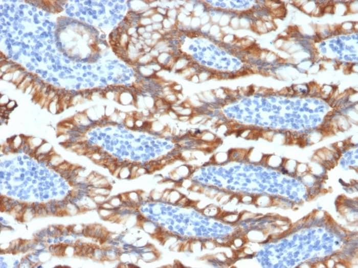 Formalin-fixed, paraffin-embedded human Small Intestine stained with Cytokeratin 8 Antibody (KRT8/2174R) - Azide and BSA Free.
