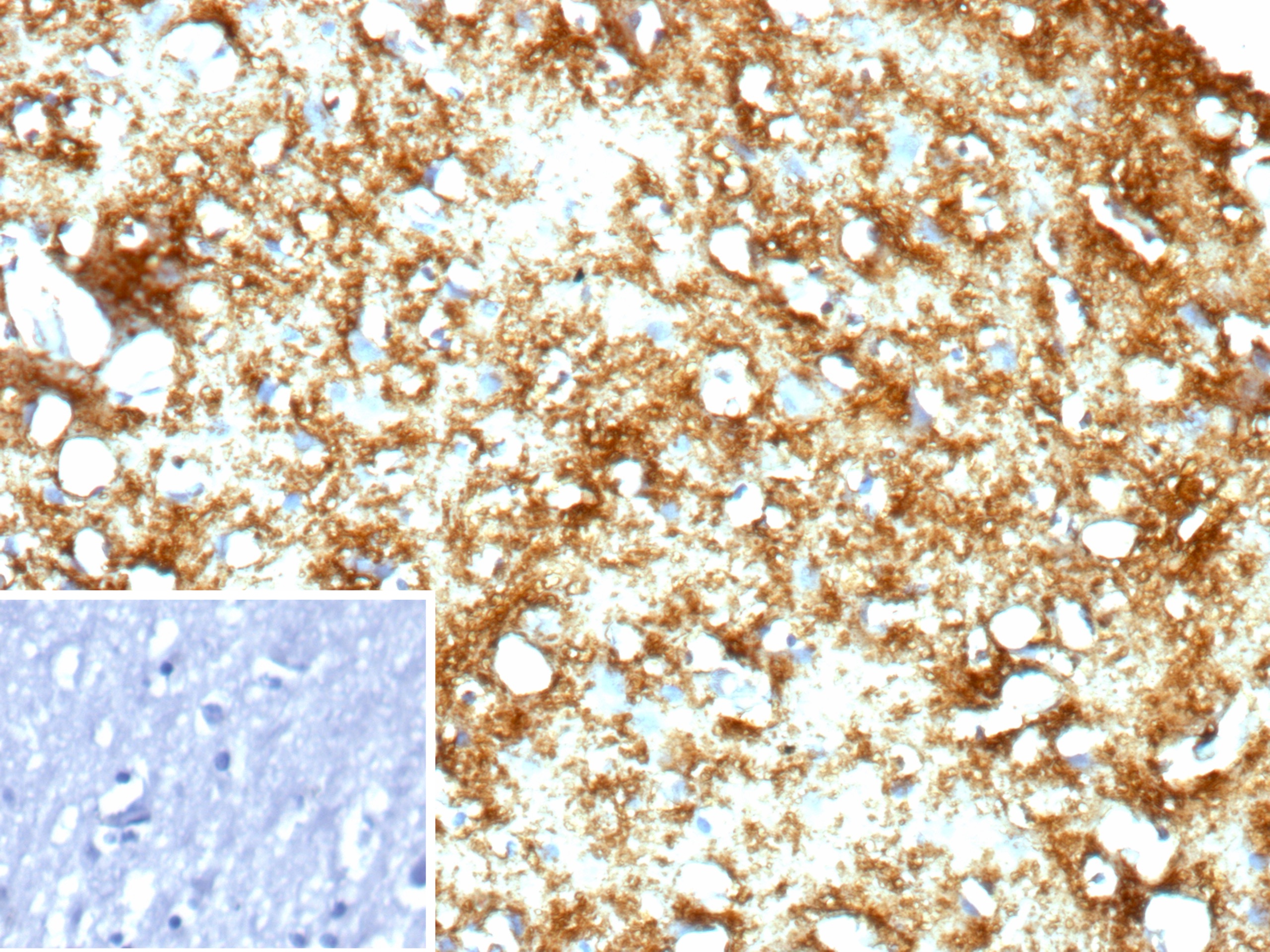 Formalin-fixed, paraffin-embedded human brain stained with MBP Antibody (rMBP/9431) - Azide and BSA Free. Inset: PBS instead of primary antibody; secondary only negative control. 