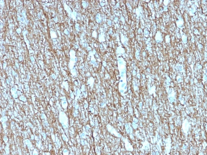 Formalin-fixed, paraffin-embedded human Brain stained with NF-H Antibody (rNF421) - Azide and BSA Free.