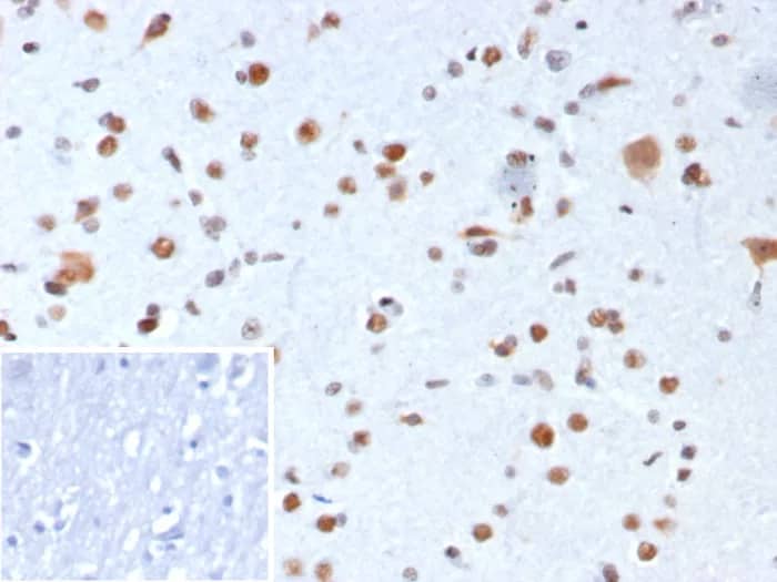 Formalin-fixed, paraffin-embedded human brain stained with NPM1 Antibody (rNPM1/8056) - Azide and BSA Free. Inset: PBS instead of primary antibody; secondary only negative control.