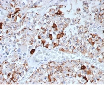 Formalin-fixed, paraffin-embedded human pituitary stained with Prolactin Antibody (rPRL/4907) - Azide and BSA Free.