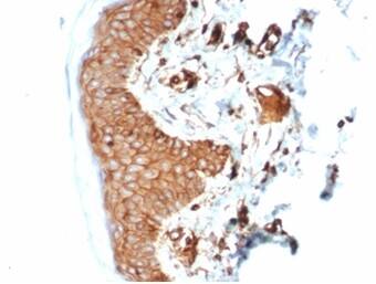 Formalin-fixed, paraffin-embedded human skin stained with beta 2-Microglobulin Antibody (B2M/7013R) - Azide and BSA Free. HIER: Tris/EDTA, pH9.0, 45min. 2�C: HRP-polymer, 30min. DAB, 5min.