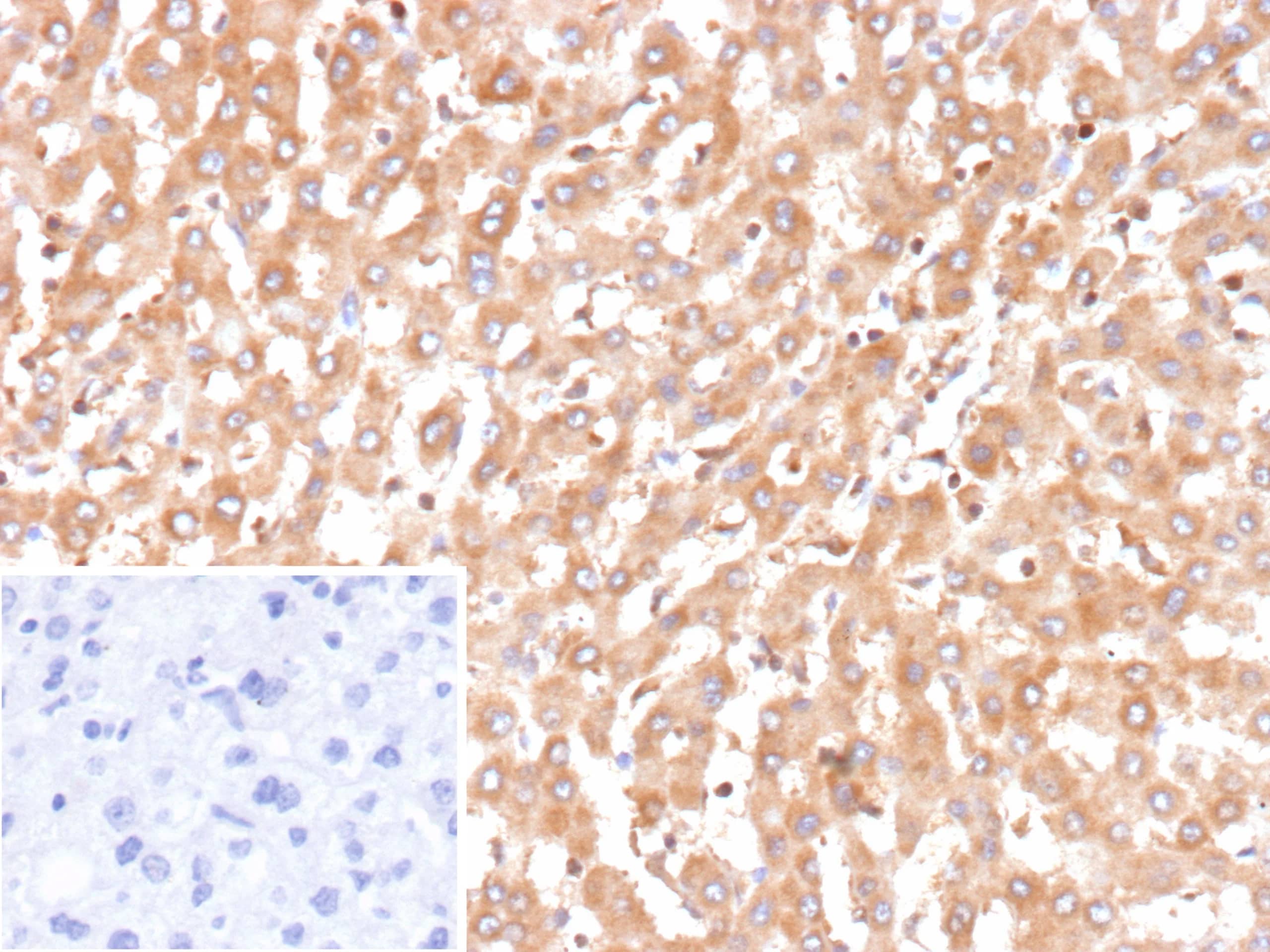 Formalin-fixed, paraffin-embedded human liver stained with Bax Antibody (BAX/9925R) - Azide and BSA Free. Inset: PBS instead of primary antibody; secondary only negative control. 