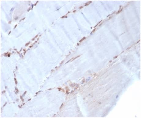 Formalin-fixed, paraffin-embedded human skeletal muscle stained with alpha-Smooth Muscle Actin Antibody (rACTA2/1625) - Azide and BSA Free.