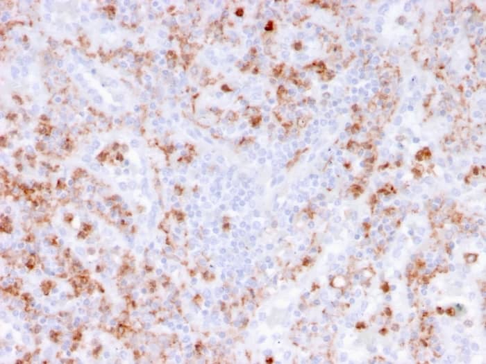 Formalin-fixed, paraffin-embedded human spleen stained with S100A9 Antibody (rMAC3781) - Azide and BSA Free.