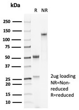 Formalin-fixed, paraffin-embedded human lung stained with SP-D Antibody (SFTPD/7084R) - Azide and BSA Free.