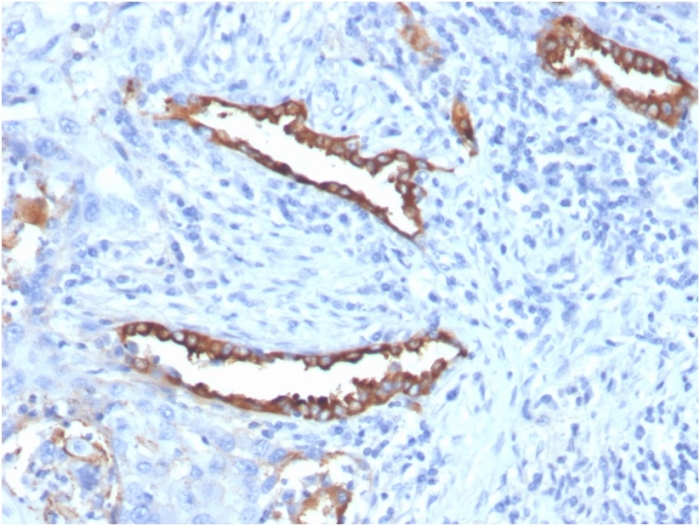 Formalin-fixed, paraffin-embedded human lung stained with SP-D Antibody (SFTPD/7085R) - Azide and BSA Free.