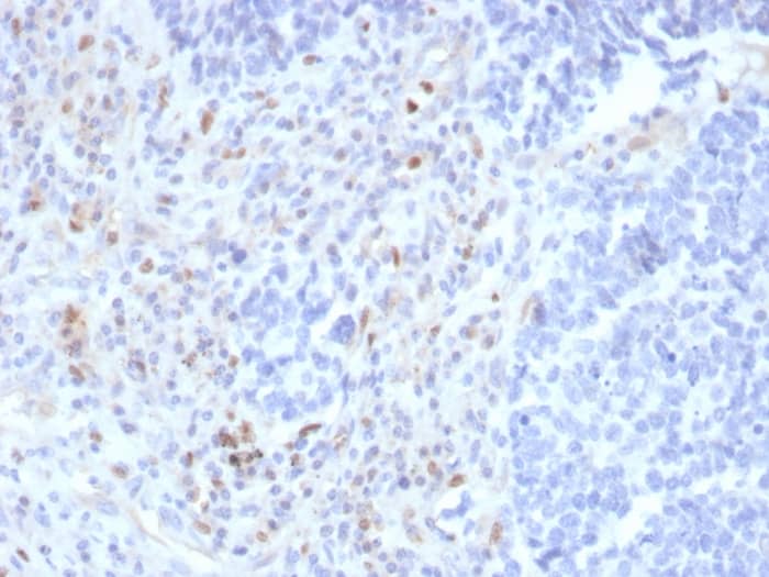 Formalin-fixed, paraffin-embedded human lymph node stained with PU.1/Spi-1 Antibody (rPU1/2146) - Azide and BSA Free.