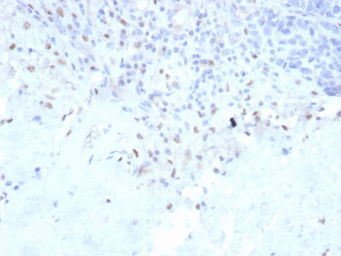 Formalin-fixed, paraffin-embedded human lymph node stained with PU.1/Spi-1 Antibody (rPU1/2146) - Azide and BSA Free.