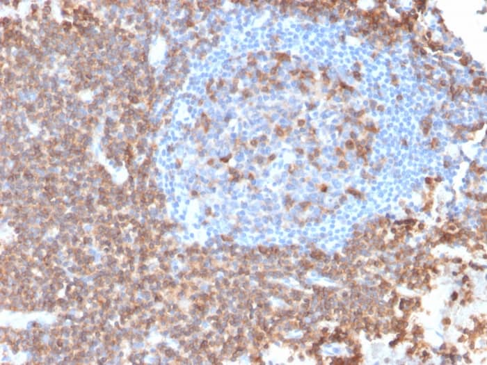 Formalin-fixed, paraffin-embedded human Lymph Node stained with CD43/Sialophorin Antibody (rSPN/839) - Azide and BSA Free.