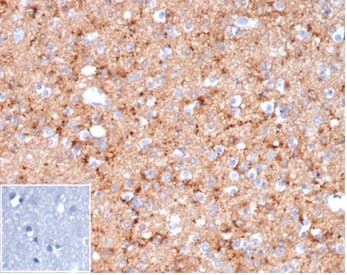 Formalin-fixed, paraffin-embedded human brain stained with Synaptophysin Antibody (rSYP/6856) - Azide and BSA Free at 2ug/ml. HIER: Tris/EDTA, pH9.0, 45min. 2�C: HRP-polymer, 30min. DAB, 5min. Inset: PBS instead of primary. Secondary antibody negative control.