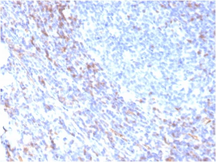 Formalin-fixed, paraffin-embedded human tonsil stained with ZAP70 Antibody (rZAP70/2046) - Azide and BSA Free.