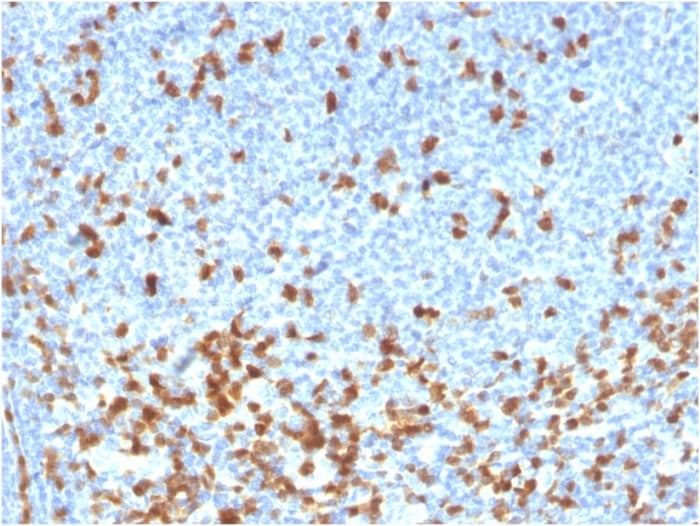 Formalin-fixed, paraffin-embedded human lymphoma stained with ZAP70 Antibody (rZAP70/2046) - Azide and BSA Free.