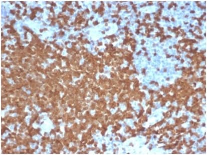 Formalin-fixed, paraffin-embedded human tonsil stained with ZAP70 Antibody (ZAP70/6492R) - Azide and BSA Free.