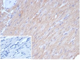 Formalin-fixed, paraffin-embedded human smooth muscle stained with Caldesmon/CALD1 Antibody (rCALD1/7266) - Azide and BSA Free. Inset: PBS instead of primary antibody; secondary only negative control.