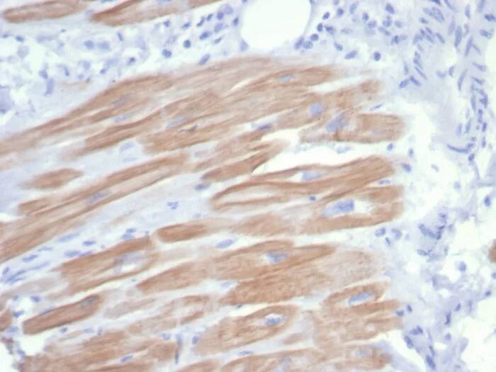 Formalin-fixed, paraffin-embedded human heart muscle stained with Alpha Actinin 2 Antibody (rACTN2/7361) - Azide and BSA Free. HIER: Tris/EDTA, pH9.0, 45min. 2�C: HRP-polymer, 30min. DAB, 5min.