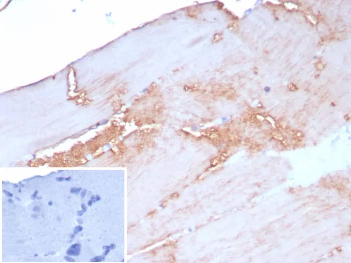 Formalin-fixed, paraffin-embedded human skeletal muscle stained with Alpha Actinin 2 Antibody (rACTN2/8177) - Azide and BSA Free. Inset: PBS instead of primary antibody; secondary only negative control.