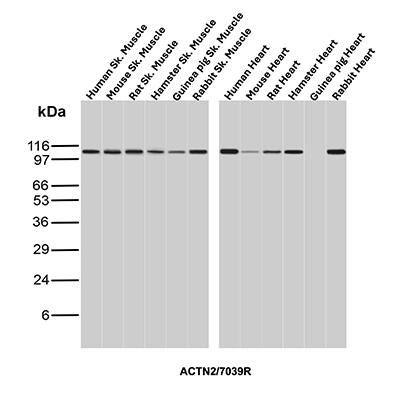 Western blot analysis of Skeletal muscle and Heart tissue lysates of different species using Alpha Actinin 2 Antibody (ACTN2/7039R) - Azide and BSA Free.