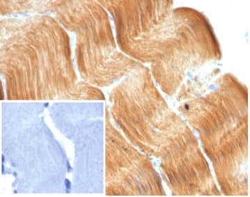 Formalin-fixed, paraffin-embedded human skeletal muscle stained with Alpha Actinin 2 Antibody (ACTN2/7040R) - Azide and BSA Free. Inset: PBS instead of primary antibody; secondary only negative control.