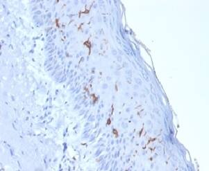 Formalin-fixed, paraffin-embedded human skin stained with CD1a Antibody (rC1A/711) - Azide and BSA Free. HIER: Tris/EDTA, pH9.0, 45min. 2�C: HRP-polymer, 30min. DAB, 5min.