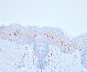 Formalin-fixed, paraffin-embedded human skin stained with CD1a Antibody (rC1A/711) - Azide and BSA Free.