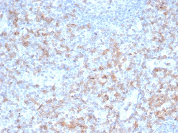 Formalin-fixed, paraffin-embedded human tonsil stained with CD5 Antibody (rC5/6462) - Azide and BSA Free.