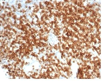 Formalin-fixed, paraffin-embedded human tonsil stained with CD6 Antibody (C6/7022R) - Azide and BSA Free.